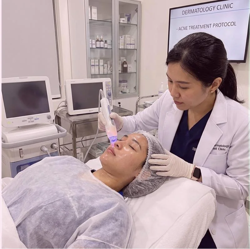 Acne Treatment 3