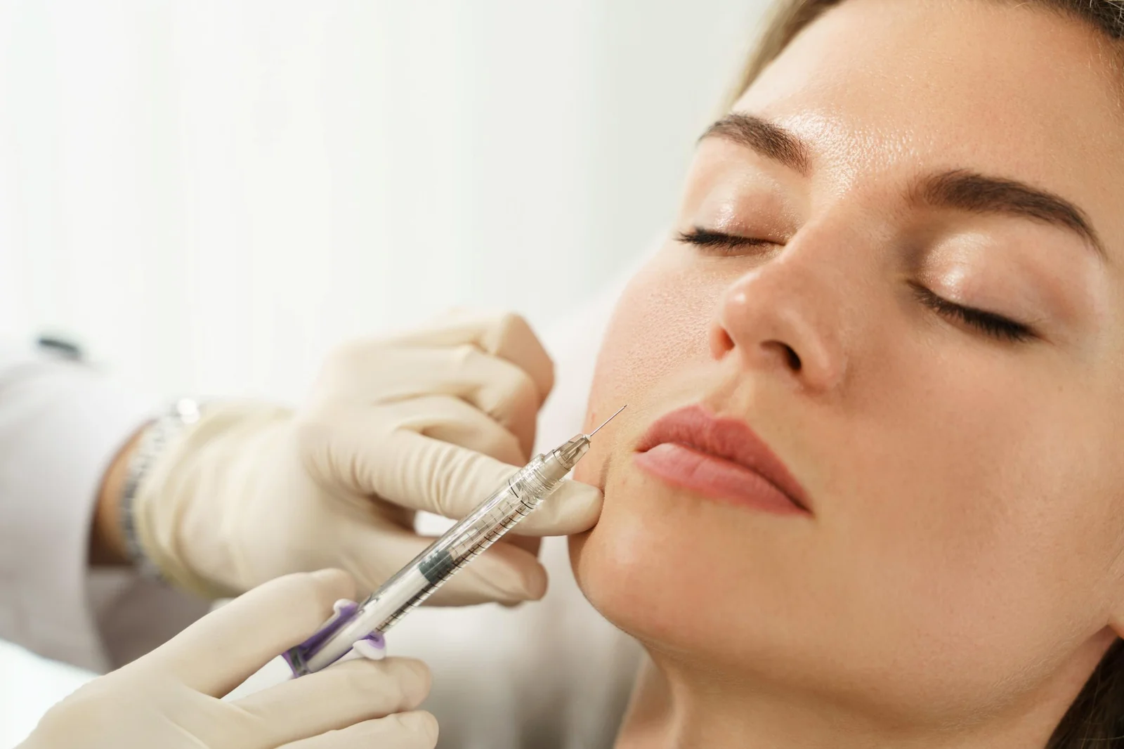 Dermal-Filler-Treatment-2