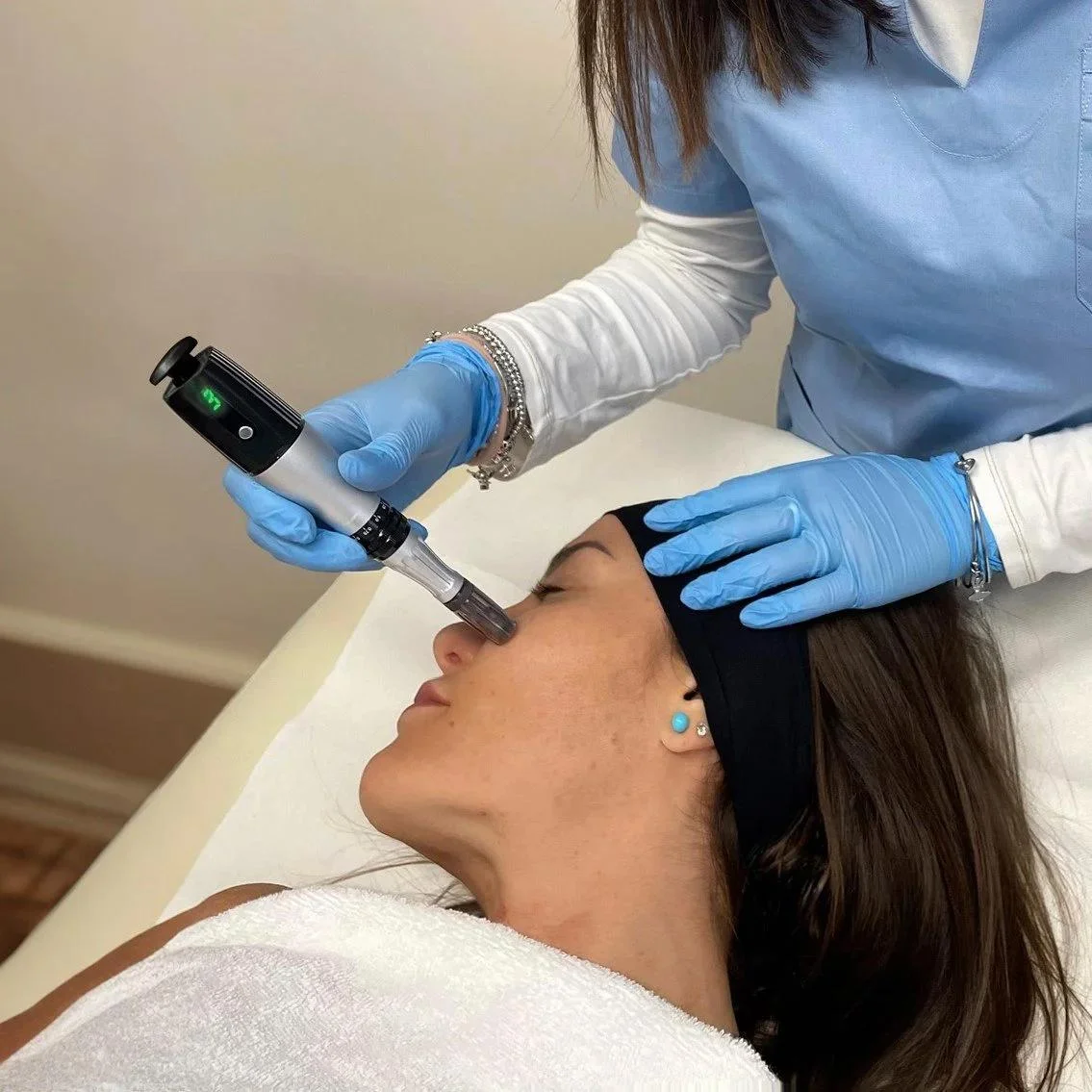 Microneedling-1